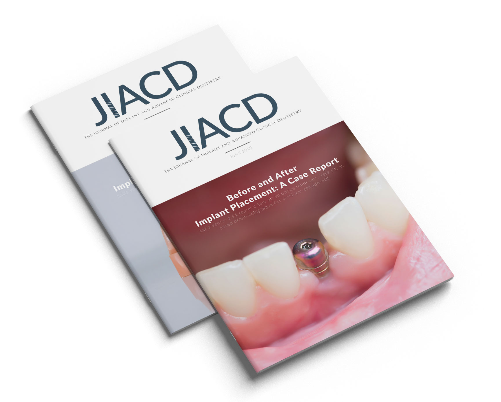Journal Covers